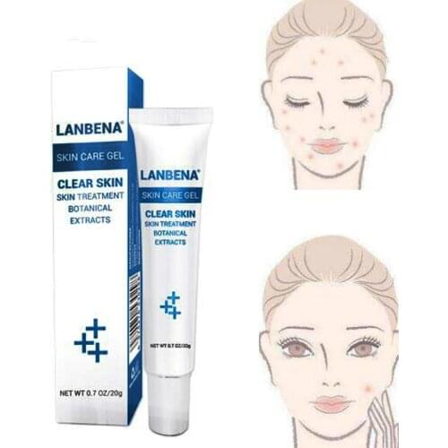 Anti Acne Moisturizing Gel cream Oil Control Shrink Pores oily skin Acne Spots Face skin care repairing Shrink Pores