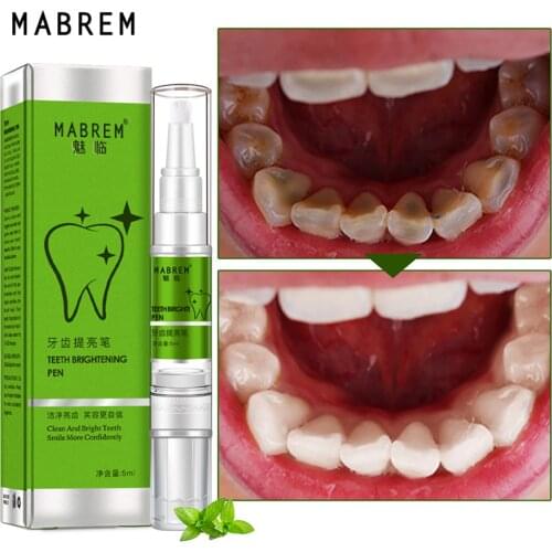 MABREM Magic Natural Teeth Whitening Gel Pen Oral Care Remove Stains Tooth Cleaning Teeth Whitener Tools Dental Toothpaste