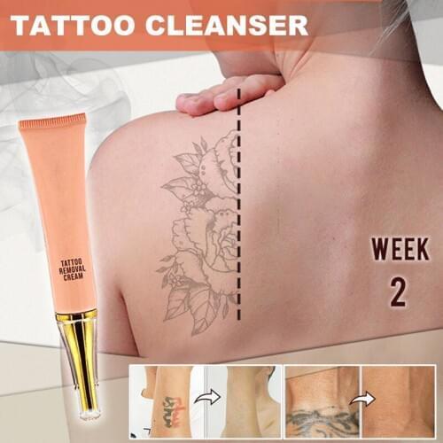 Tattoo Removal Cream Painless Remove Tattoo Ink Remover Without Scarring No Hurt Safe Gentle MPwell