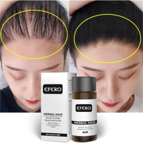 Efero hair nutrient growth liquid anti-drop 20ml hair growth liquid plant nourishes the hair and thickens