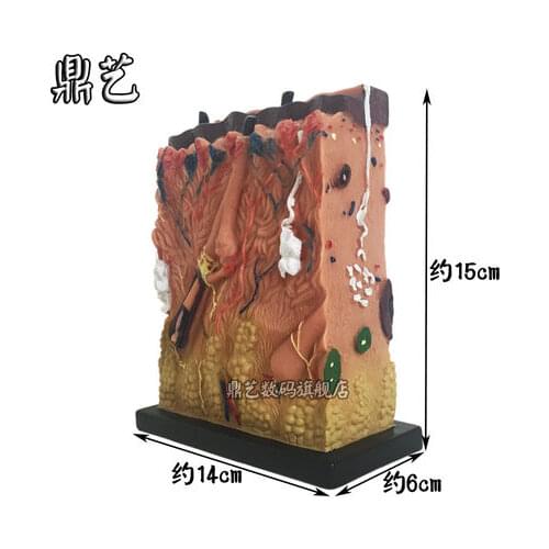 Small Skin structure model Biological instrument teaching aids 15*14*6cm free shipping