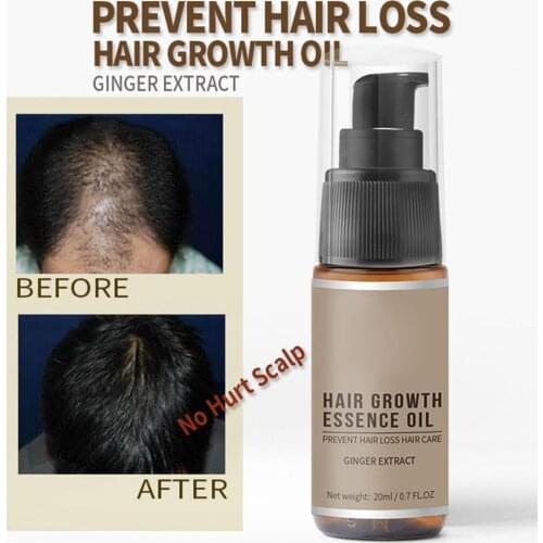 20ml Fast Powerful Hair Growth Essence Hair Loss Products Essential Oil Liquid Treatment Preventing Hair Loss Hair Care Products
