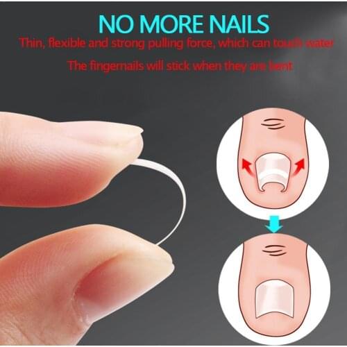 Ingrown Toenail Correction Sticker Ingrowing Nail Correction Tool Shape Orthopedic Patch Foot Patch Nail Care Correction 10 S6X3