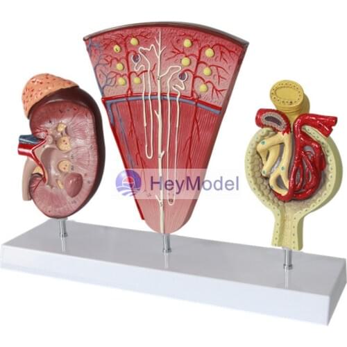HeyModel Cecum and appendix model ileum model Lymphatic and Gastrointestinal Teaching Model Intestinal model