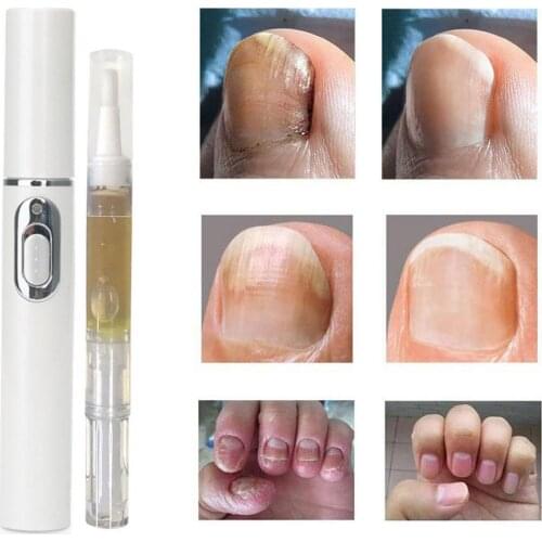 20g Nail Repair Solution And Laser Pen Set Nail Polish Liquid Suit Restores Discolored & Damaged Nails Nail Care Solution 2020
