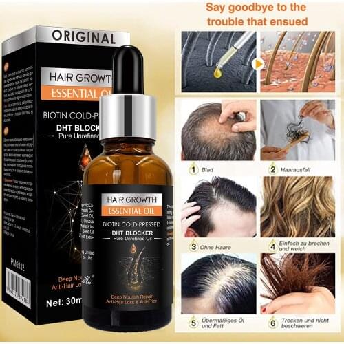 30ml DISAAR Ginger Hair Care Set Scalp Dandruff & Oil Removal Strong Hair Root Repair Hair Quality Essential Oil Wholesale