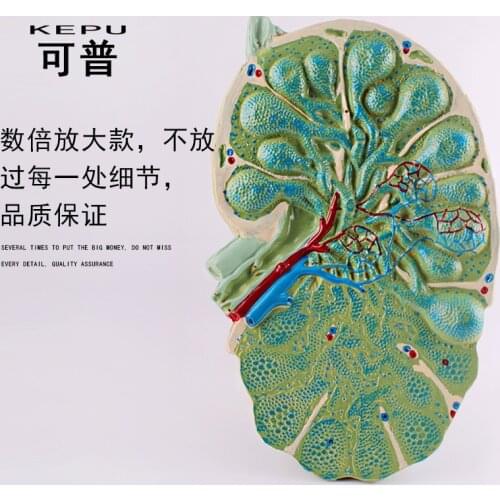 Human Lymph Node Enlargement Model Detachable Teaching Laboratory Equipment Medical Demonstration Aids