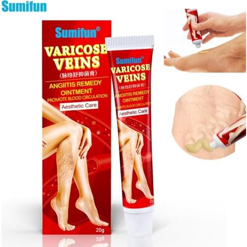 Sumifun 20G Chinese Herbal Varicose Vein Treatment Cream Varicosity Angiitis Remedy Ointment Phlebitis Spider Cream K10011