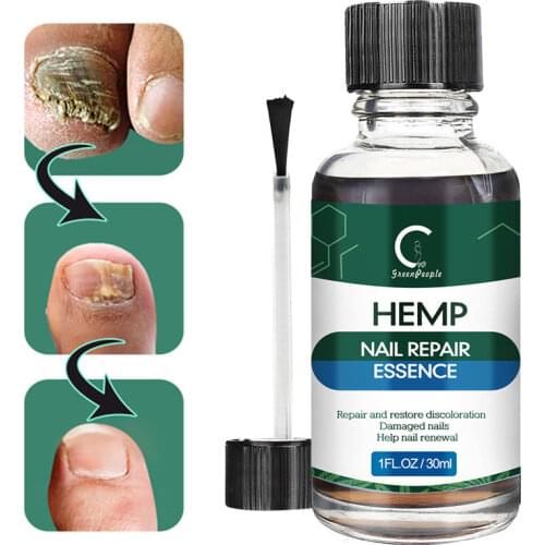 GPGP Nail Fungal Treatment Feet Care Essence Nail Foot Whitening Toe Nail Fungus Removal Gel Anti Infection Paronychia Onychomy