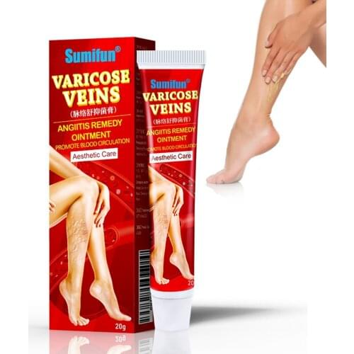 2 Piece Varicose Vein Ointment Vasculitis Cream Varicosity Phlebitis Removal Plaster 20g