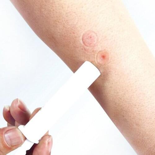 Mosquito Bites Itching Instant Bug Bite Relief Extraction Vacuum Pump Bug Insect Bite Relief Mosquito Repellent 3