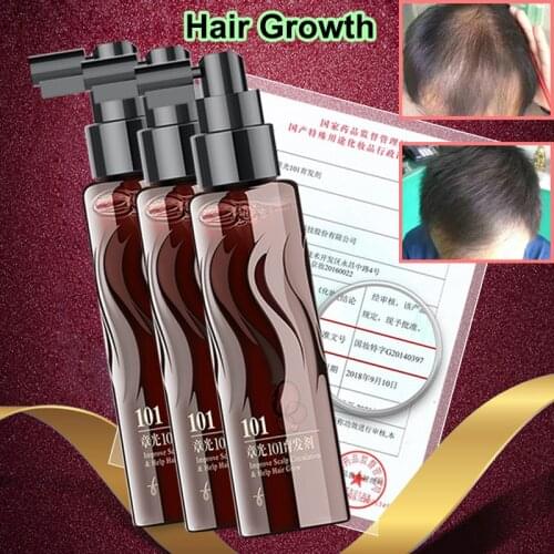 ZHANG GUANG 101P (101 formula) 120ml Chinese medicine therapy anti hair loss hair care nourish the hair follicle hair regrowth