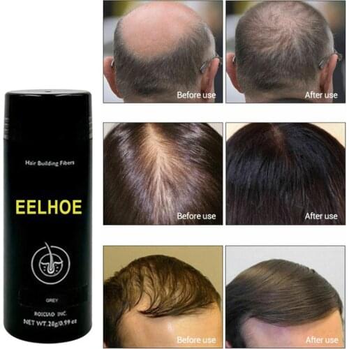 1 Bottle Of Keratin Hair Loss Building Fiber Spray Hairline Optimizer Dense Organic Hair Growth Hair Building Fibers Men Women