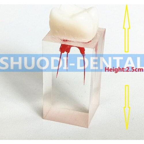4pcs 1:1 Tooth Practice Operation Model Pulp Clear Enodontic Instruments High Quality Dentistry Dental Exam Pratice Pulp Root