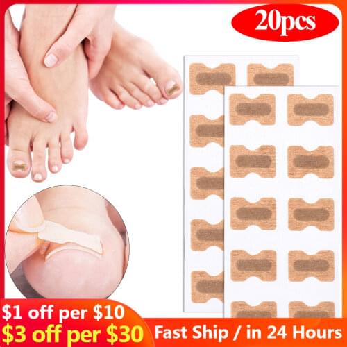 20/50/100pcs Nail Correction Stickers Ingrown Toenail Corrector Patches Paronychia Treatment Recover Corrector Pedicure Tools