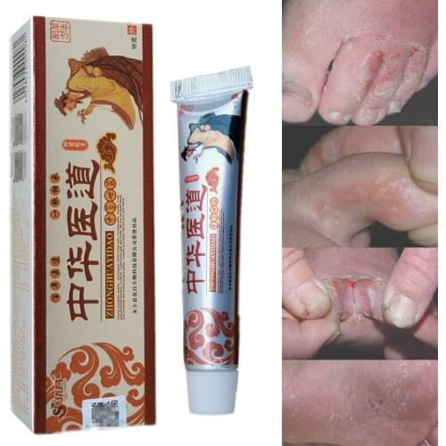 Natural plant hotsale Eczema Antibacterial Cream Psoriasis Dermatitis Cream chinese Herb Medical Ointment Plaster Skin Care 2pcs