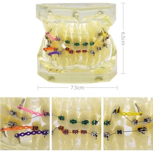 Dental Orthodontics Teeth Model Dentist Teaching Training Malocclusion Orthodontic Teeth Model with Brackets Buccal Tubes Chain