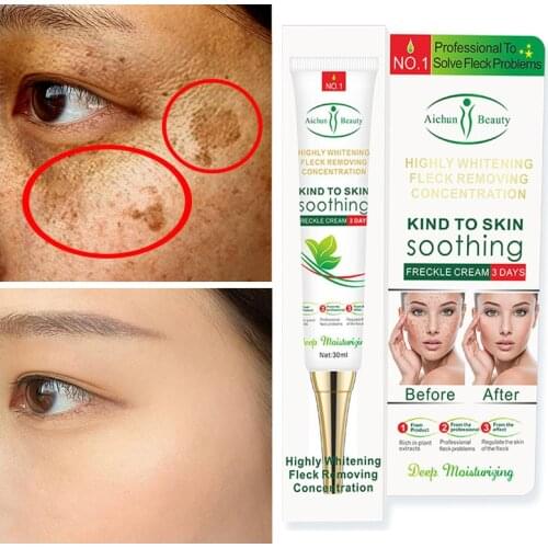 Face Cream Effective Remove Whitening Freckle Melasma Spot Pigment Melanin Dark Spots Pigmentation Moisturizing Gel Skin Care