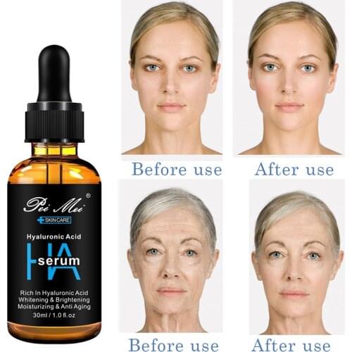 30ml Hyaluronic Acid Face Serum Anti-Aging Shrink Pores Moisturizing Facial Essence Improve Dry Skin Care Whitening Skin Liquid