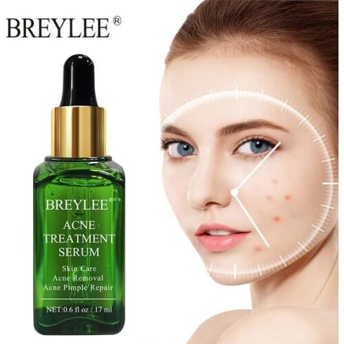 BREYLEE Acne Treatment Face Serum Hyaluronic Acid Moisturizing Nourish Essence Liquid Anti-Wrinkle Anti-Aging Brighten Skin Care
