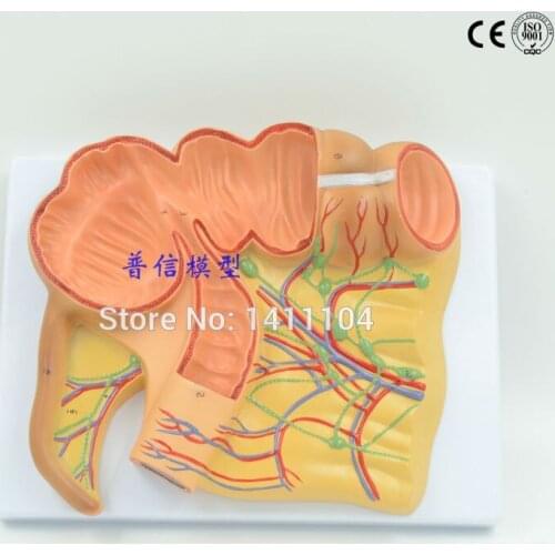 Free shipping&Appendix model of the appendix, ileum model, digestive system model, human anatomy model.For teaching medical
