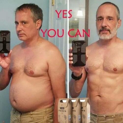 10/30/50PCS Burning Fat&Lose Weight Belly Navel Sticker Extra Strong Slimming Patch Fast Detox Adhesive Sheet Waist Body Shaping