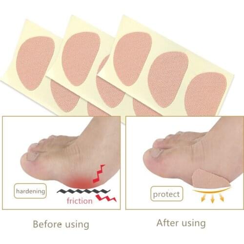 1PC Sumifun Foot Corn Removal Killer Calluses Plantar Warts Thorn Pain Relief Curative Plaster Medical Sticker Curative Plaster