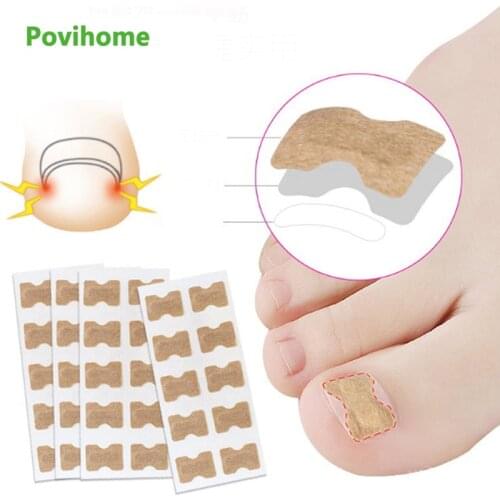 10Pcs/Set Ingrown Toenail Correction Patch Toenail Brace Pedicure Tool Double-sided Tape Nail Repair