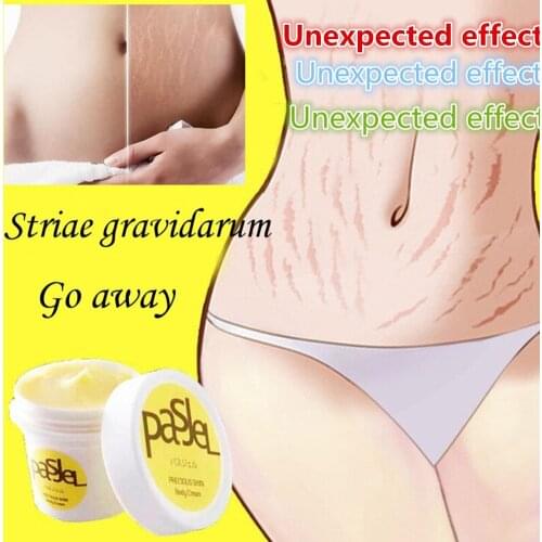 Natural Plant Formula Stretch Mark Repair Cream Powerful Obesity Pregnancy Skin Postpartum Stretch Marks Obesity Remove Cream