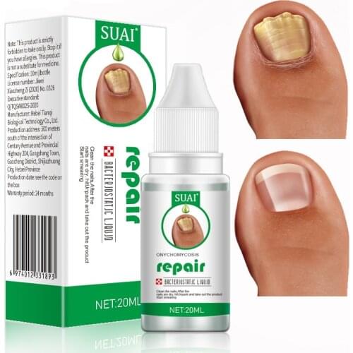 SUAI 20ML Nail Fungus Treatment Feet Care Essence Fungal Nail Foot Toe Repair Removal Gel Anti Infection Paronychia Onychomycosi