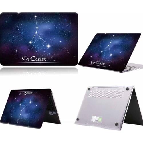 Laptop Case for Huawei MateBook D14 D15/13 14/X 2020/X Pro 13.9/Honor MagicBook 14/15/Pro 16.1 Anti-fall Laptop Hard Shell Cover