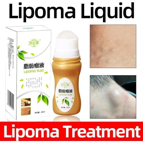 40ml Lipoma Remove Spray Herbal Medicine Anti-Tumor Peeling liquid Body Hard Block Anti-Sticking Nemesis