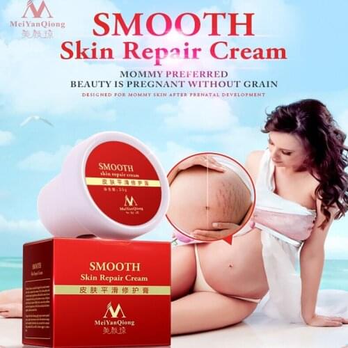 35g Removal Scar Cream Face Pimples Scar Stretch Marks Removal Acne Treatment Whitening Moisturizing Cream Skin Care