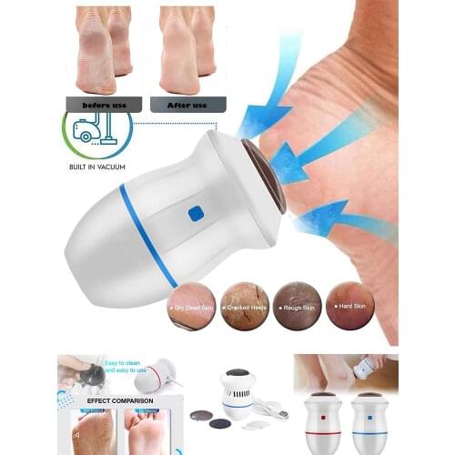 Nueva máquina de limar de pies al vacío eléctrica exfoliante eliminador de callos de piel muerta talón espátula de remoción Vacu