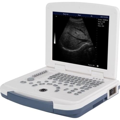 China Cheapest Price Medical Hospital Diagnosis Equipment Portable Laptop Ultrasound Scanner Machine for pregnancy
