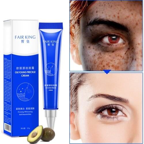 Skin Whitening Reduces Age Spots Freckles Face Cream 20g Dark Spot Corrector Fade Cream Lightening Blemish Removal Serum