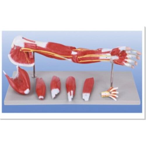BIX-A1033 Upper Limbs Anatomical Model,Muscle Anatomy Model WBW411