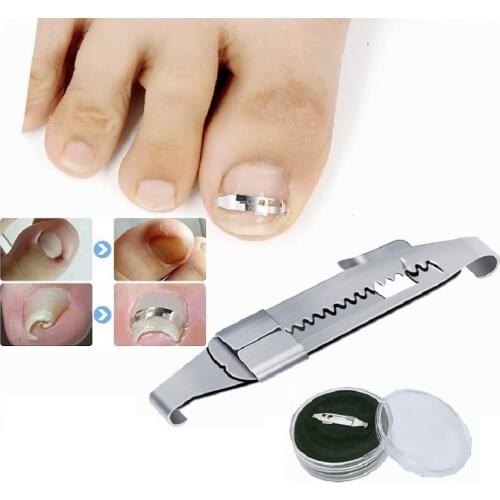 Ingrown Toenail Pedicure Tools Professional Recover Embed Toe Nail Treatment Paronychia Bunion Hallux Valgus Corrector Foot Care