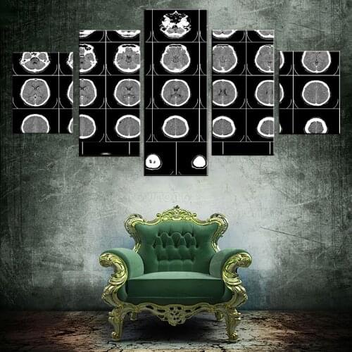 5 Pieces Technology X-Ray Canvas Painting Computer Tomography Posters Pictures Body Part Wallpapers For Home Room Clinic Decor