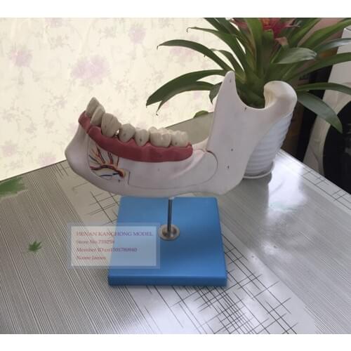 ISO Lower Jaw of 18-year-old,Anatomical Model Adult Teeth,Adult Jaw Teeth Model