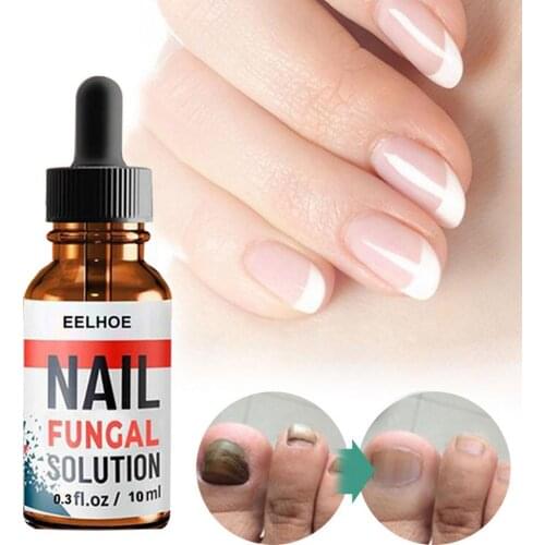 30ML Nail Repair Solution Against Discolored & Damaged Nails Fungal Nail Pen Effective Onychomycosis Paronychia Fungus Infection