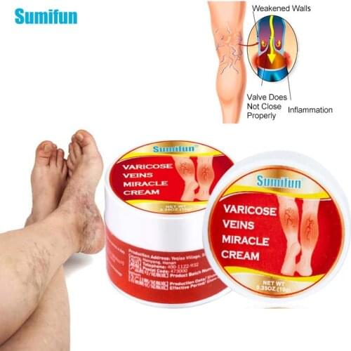 2pcs Varicose Veins Ointment 100% Original Vasculitis Phlebitis Spider Treatment Cream Medical Herbal Plaster Skin Care K20007