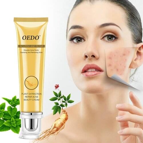 Ginseng Extract Acne Removal Facial Essence Face Cream Herbal Natural Plant Extract Moisturizer Smooth Skin Care Cream