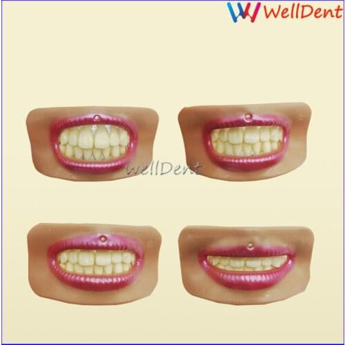 Dental Mouth Measuring Lip Denture Dental Materials Laboratory Measurement Tool Instrument Aesthetics Parts 4pcs Different Shape