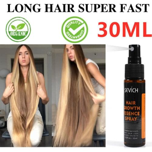 30ml Hair Growth Essence Spray Hair loss Treatment Preventing Hair Loss spray hair Growth Essence Hair Care
