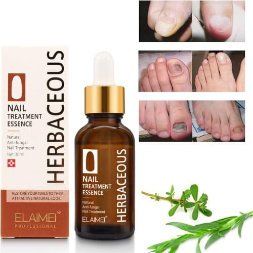 30ml Nail Nutrition Liquid Nail Care Solution Safe Effective Nail Treatment Cream Herbal Nail Fungus Treatment Nutrient Solution