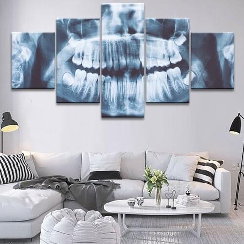 5pcs X-ray Teeth Dentist Posters Wall Art Decor Picture Canvas Wall Poster Paintings for Kids Living Home Decoration Accessories