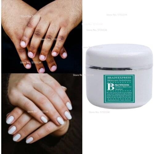 Dark Knuckles Remover Eraser, Clear Knuckles Cream for Hands Fingers Feet
