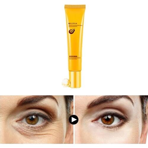 Day Night Strengthen Skin Elasticity Eye Cream Dispel Eyes Fatigue Anti- Puffiness Gel Bright Dark Circles Anti Wrinkle Mask 20g