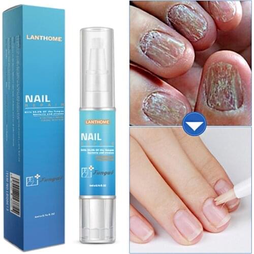 4ml Fungal Nail Treatment Pen Nail Fungal Treatment Toenails Nutritious Restores Fungus Repair Oil Solution Anti Infection N6P9